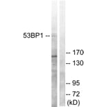 Western Blot - Anti-53BP1 Antibody (B0760) - Antibodies.com