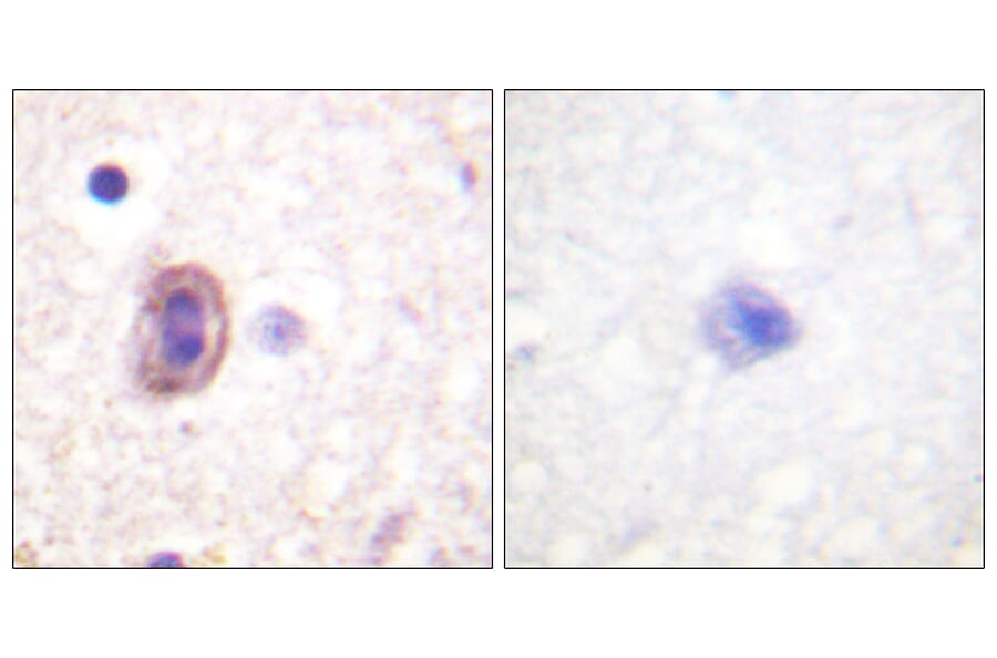 Immunohistochemistry - Anti-SEK1 Antibody (B1122) - Antibodies.com