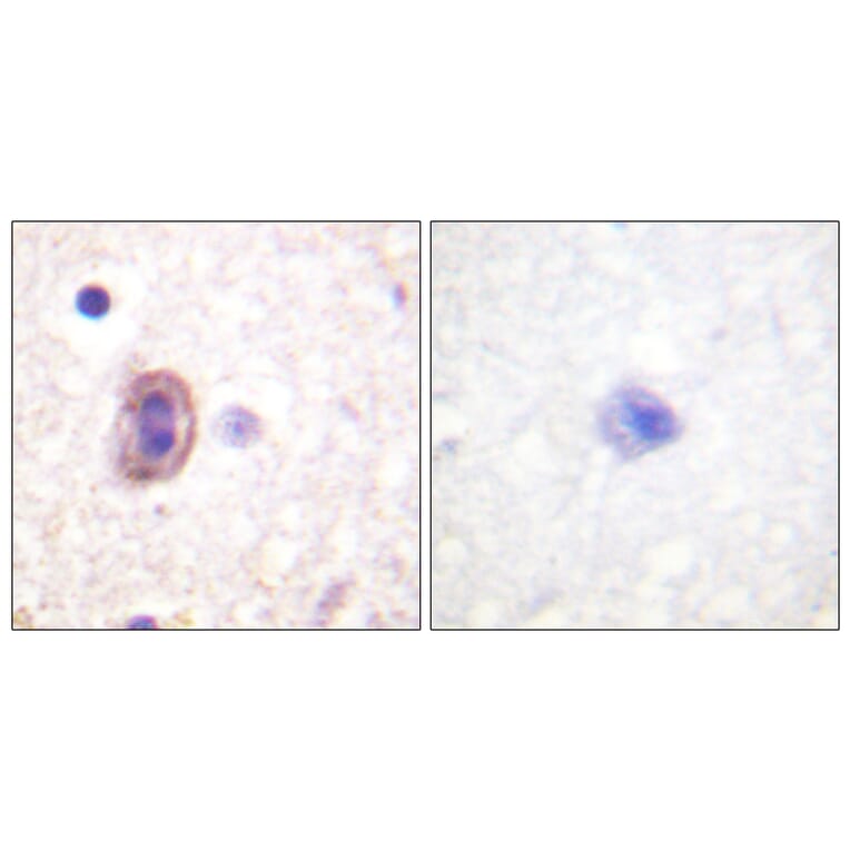 Immunohistochemistry - Anti-SEK1 Antibody (B1122) - Antibodies.com