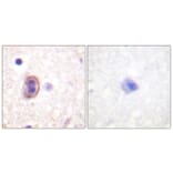 Immunohistochemistry - Anti-SEK1 Antibody (B1122) - Antibodies.com