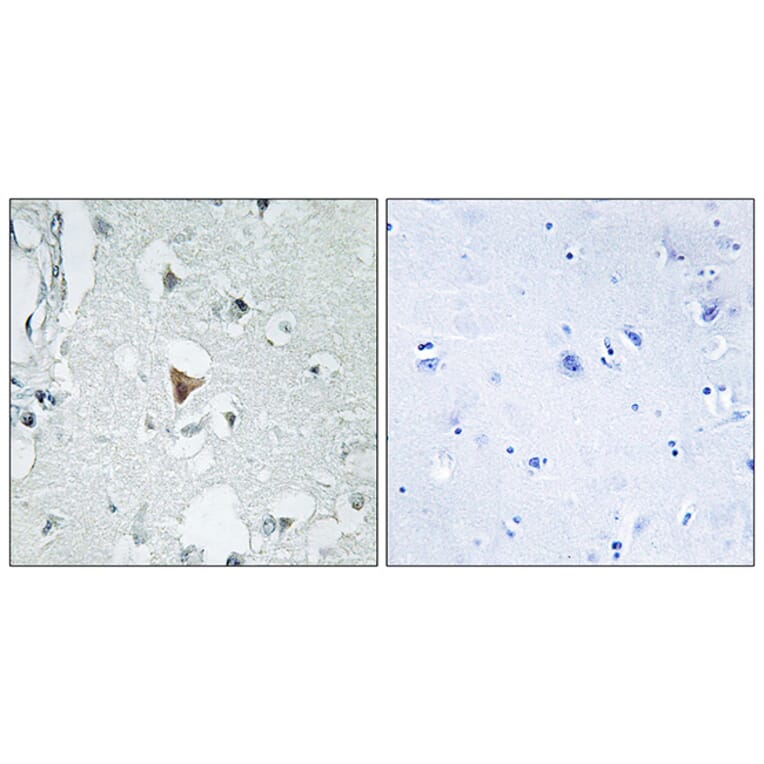 Immunohistochemistry - Anti-SAPK Antibody (B7129) - Antibodies.com