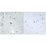 Immunohistochemistry - Anti-SAPK Antibody (B7129) - Antibodies.com