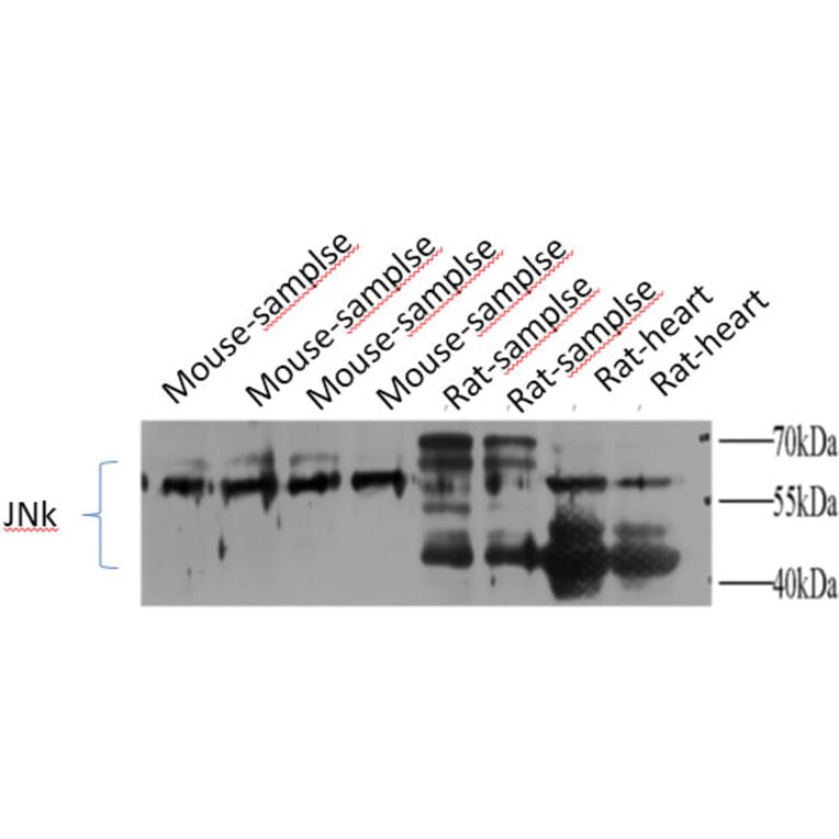 Western Blot - Anti-SAPK Antibody (B7129) - Antibodies.com