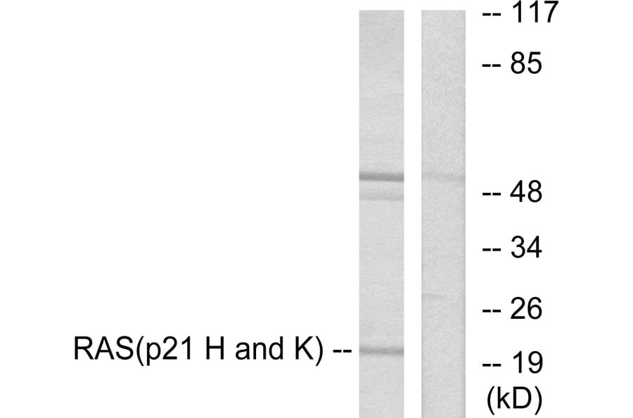 Western Blot - Anti-RASH Antibody (C0313) - Antibodies.com