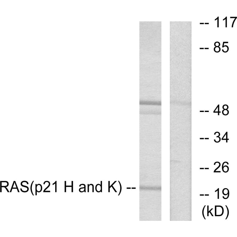 Western Blot - Anti-RASH Antibody (C0313) - Antibodies.com