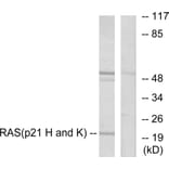 Western Blot - Anti-RASH Antibody (C0313) - Antibodies.com