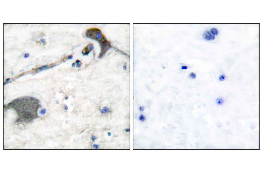 Immunohistochemistry - Anti-RASH Antibody (C0313) - Antibodies.com