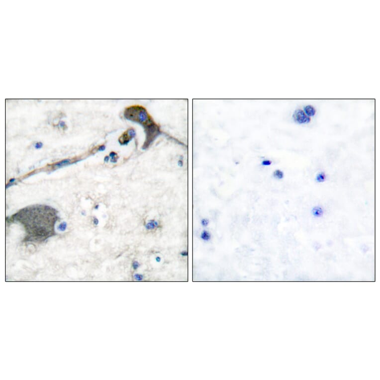 Immunohistochemistry - Anti-RASH Antibody (C0313) - Antibodies.com