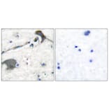 Immunohistochemistry - Anti-RASH Antibody (C0313) - Antibodies.com