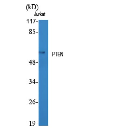 Western Blot - Anti-PTEN Antibody (B7203) - Antibodies.com