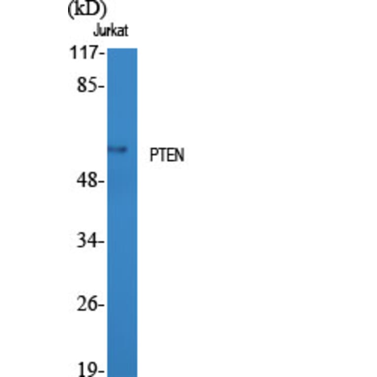 Western Blot - Anti-PTEN Antibody (B7203) - Antibodies.com