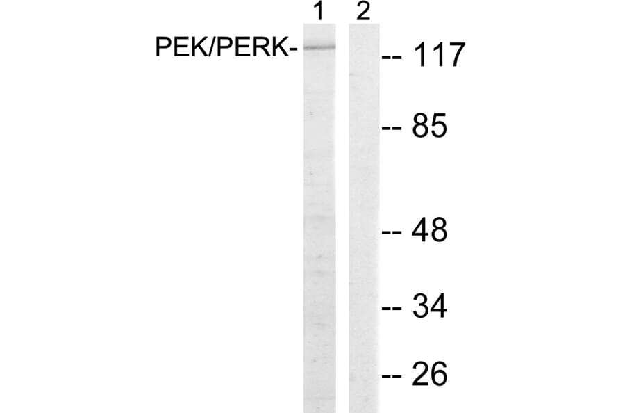 Western Blot - Anti-PERK Antibody (B8168) - Antibodies.com