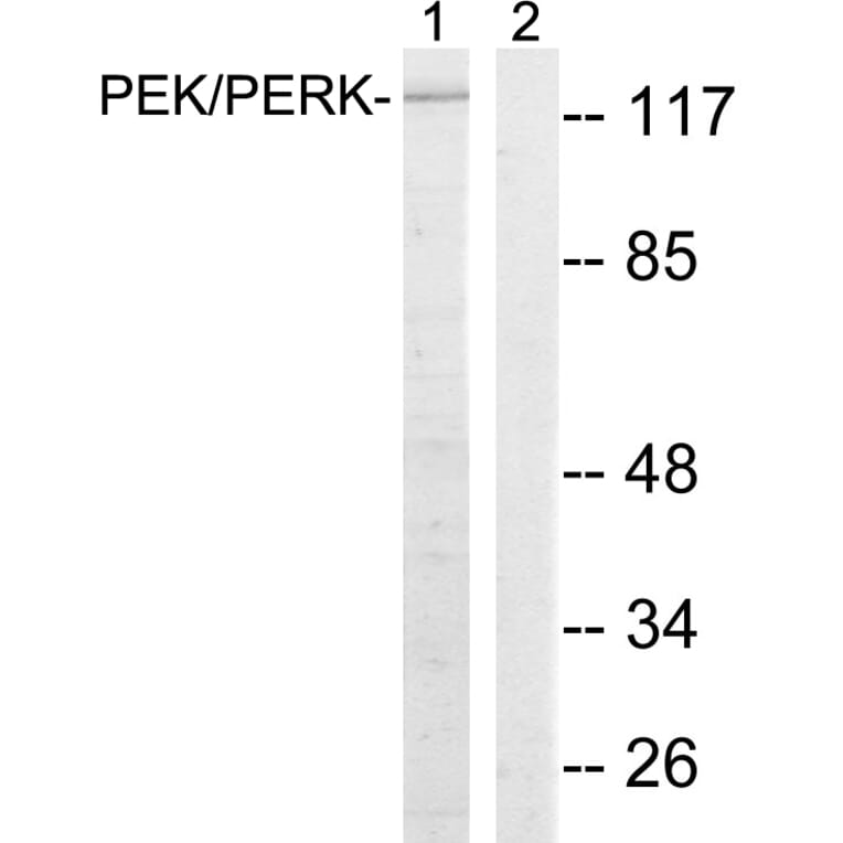 Western Blot - Anti-PERK Antibody (B8168) - Antibodies.com