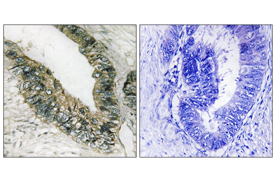 Immunohistochemistry - Anti-PERK Antibody (B8168) - Antibodies.com