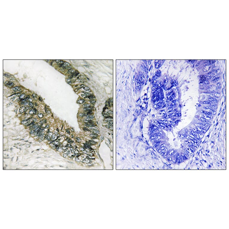 Immunohistochemistry - Anti-PERK Antibody (B8168) - Antibodies.com