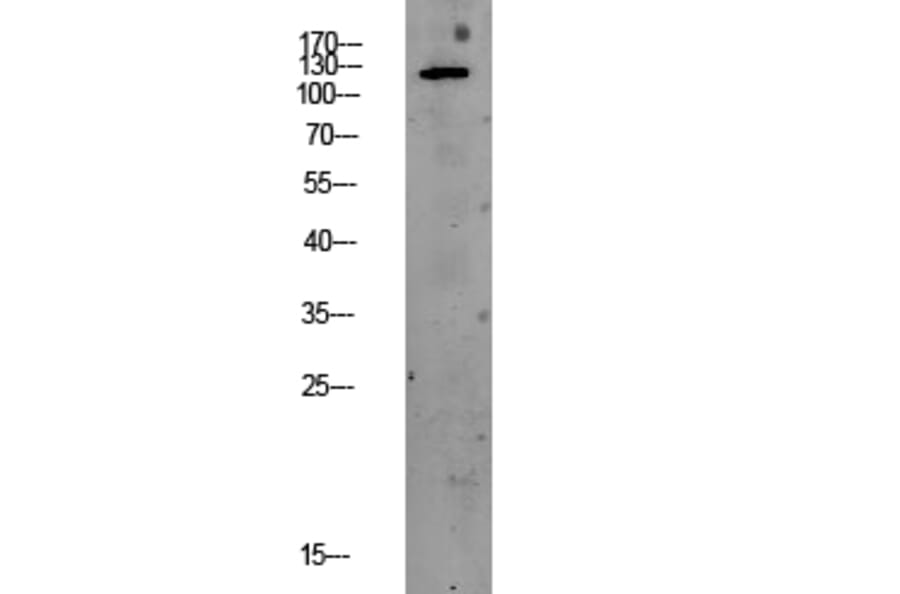 Western Blot - Anti-PERK Antibody (B8168) - Antibodies.com