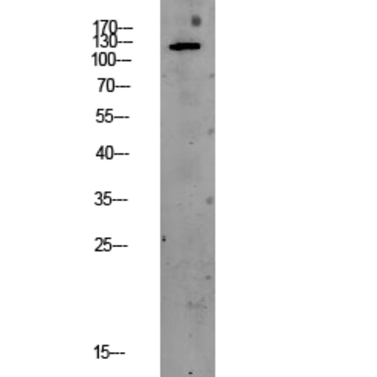 Western Blot - Anti-PERK Antibody (B8168) - Antibodies.com