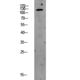 Western Blot - Anti-PERK Antibody (B8168) - Antibodies.com