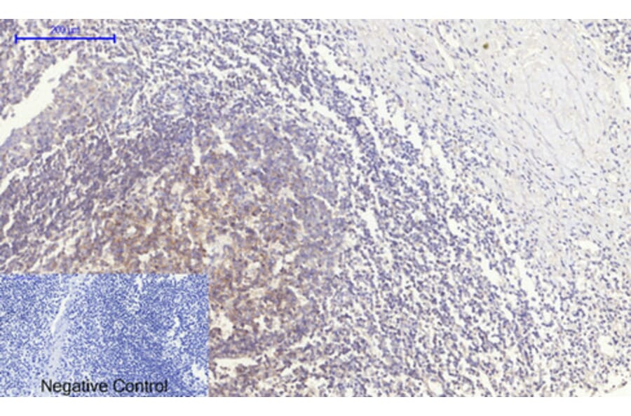 Immunohistochemistry - Anti-PERK Antibody (B8168) - Antibodies.com