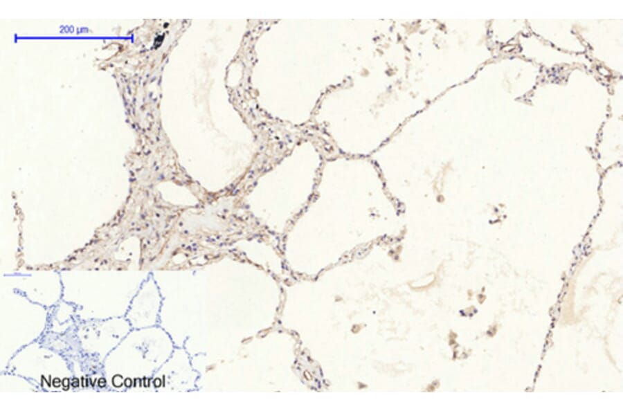 Immunohistochemistry - Anti-PERK Antibody (B8168) - Antibodies.com
