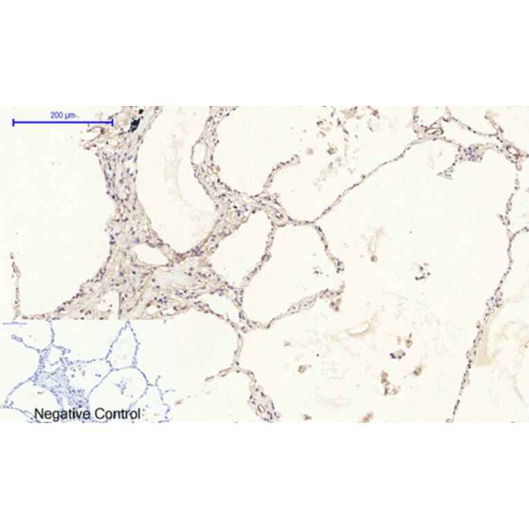 Immunohistochemistry - Anti-PERK Antibody (B8168) - Antibodies.com