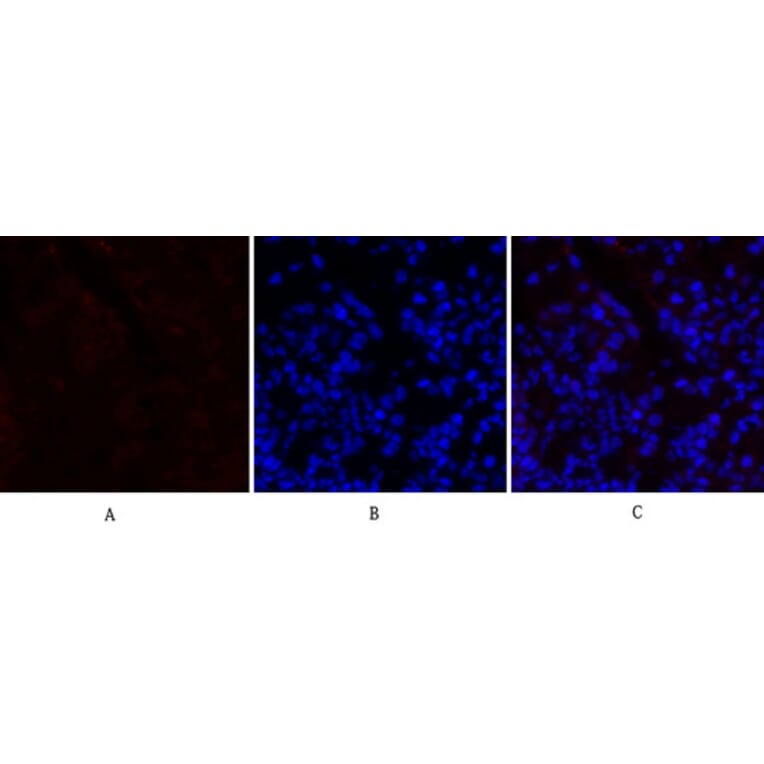 Immunofluorescence - Anti-PERK Antibody (B8168) - Antibodies.com