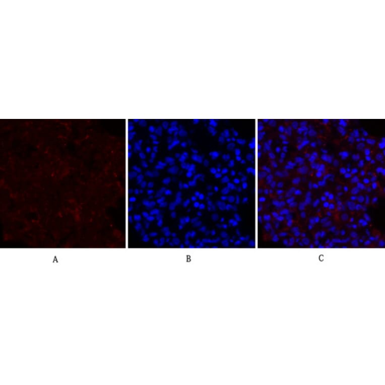Immunofluorescence - Anti-PERK Antibody (B8168) - Antibodies.com