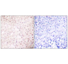 Immunohistochemistry - Anti-p300 Antibody (C0290) - Antibodies.com