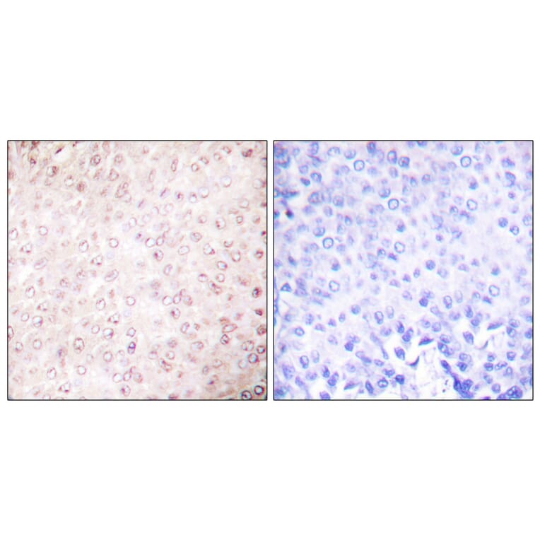 Immunohistochemistry - Anti-p300 Antibody (C0290) - Antibodies.com