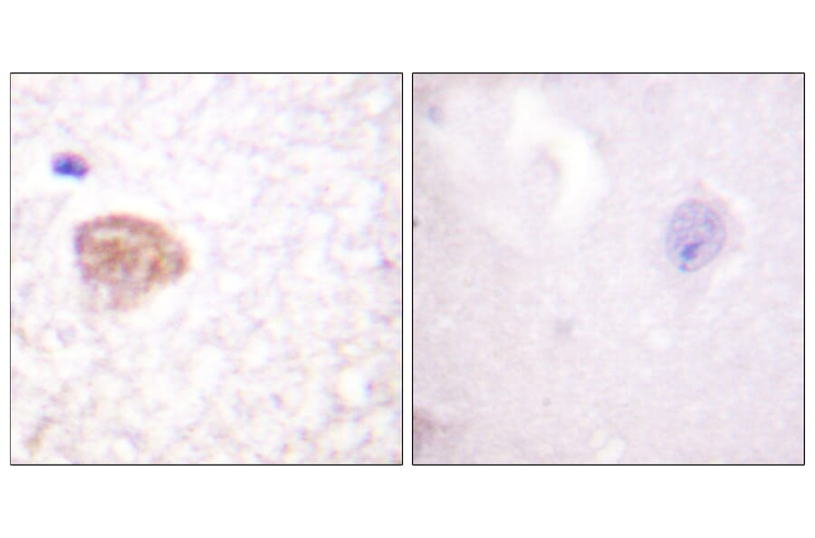 Immunohistochemistry - Anti-DDX3 Antibody (B0902) - Antibodies.com