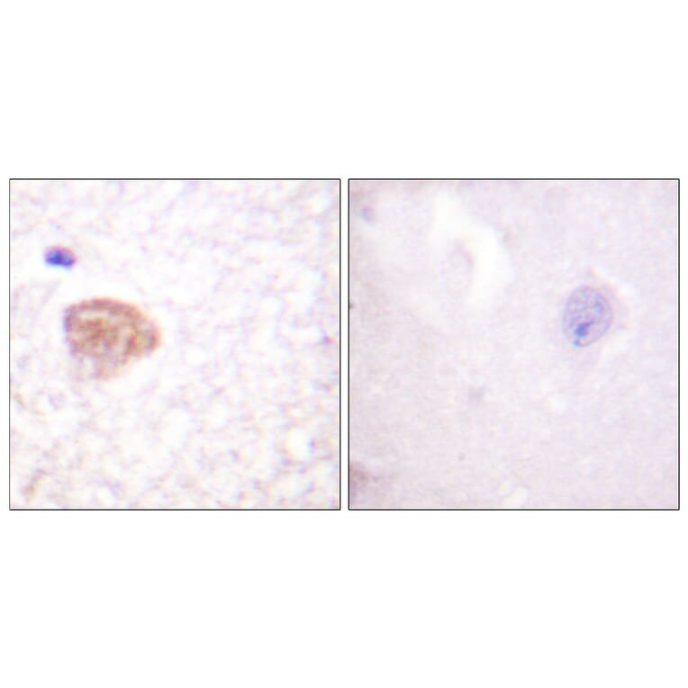 Immunohistochemistry - Anti-DDX3 Antibody (B0902) - Antibodies.com