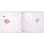 Immunohistochemistry - Anti-DDX3 Antibody (B0902) - Antibodies.com