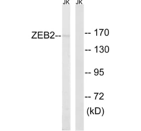 Western Blot - Anti-ZEB2 Antibody (C10133) - Antibodies.com