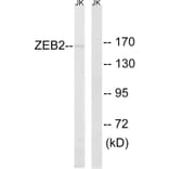 Western Blot - Anti-ZEB2 Antibody (C10133) - Antibodies.com