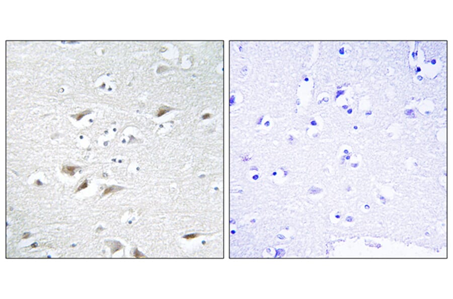 Immunohistochemistry - Anti-ZEB2 Antibody (C10133) - Antibodies.com