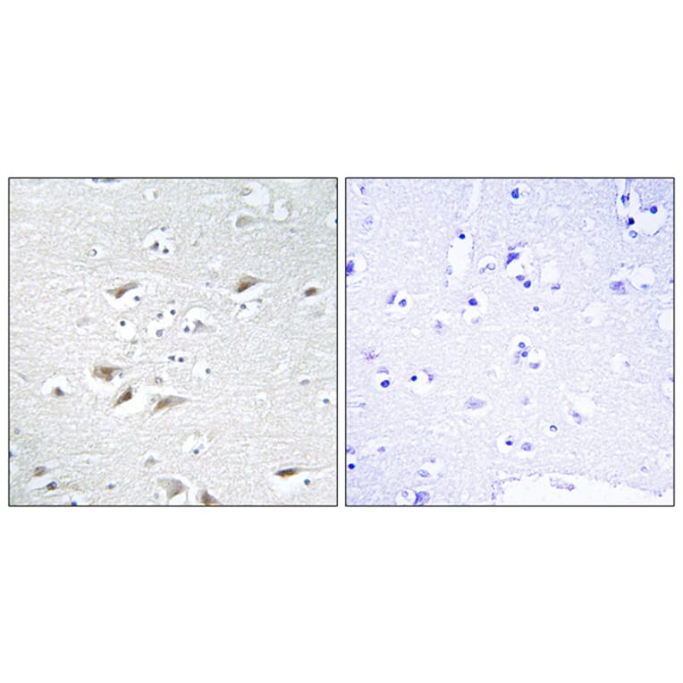 Immunohistochemistry - Anti-ZEB2 Antibody (C10133) - Antibodies.com