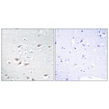 Immunohistochemistry - Anti-ZEB2 Antibody (C10133) - Antibodies.com