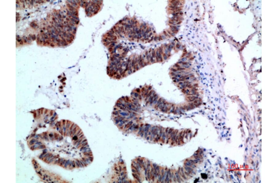Immunohistochemistry - Anti-YARS Antibody (C30881) - Antibodies.com