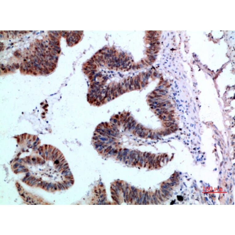 Immunohistochemistry - Anti-YARS Antibody (C30881) - Antibodies.com