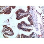 Immunohistochemistry - Anti-YARS Antibody (C30881) - Antibodies.com