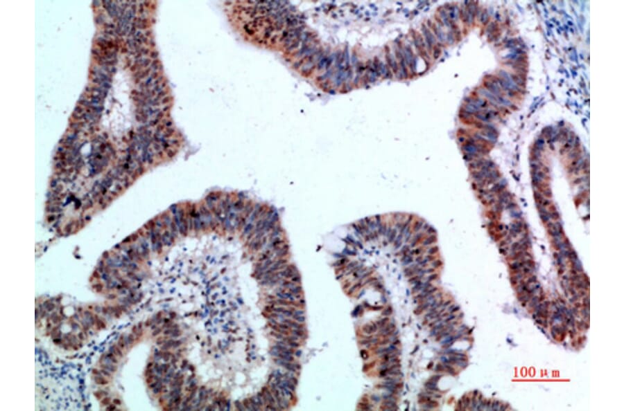 Immunohistochemistry - Anti-YARS Antibody (C30881) - Antibodies.com