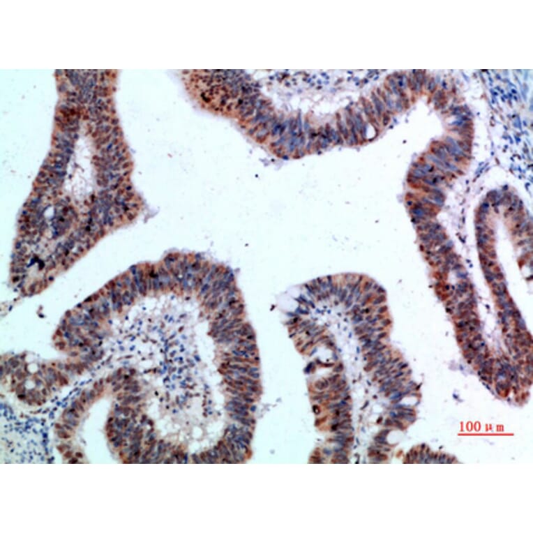 Immunohistochemistry - Anti-YARS Antibody (C30881) - Antibodies.com