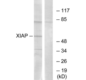 Western Blot - Anti-XIAP Antibody (B0599) - Antibodies.com