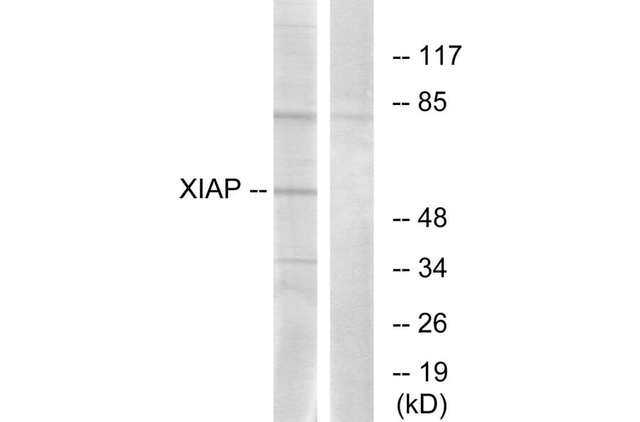 Western Blot - Anti-XIAP Antibody (B0599) - Antibodies.com