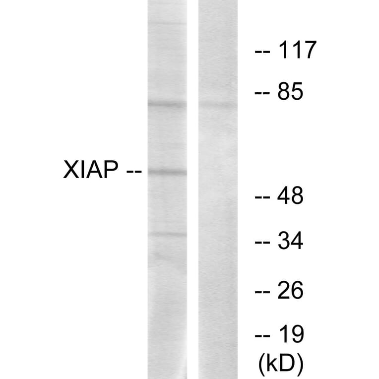 Western Blot - Anti-XIAP Antibody (B0599) - Antibodies.com