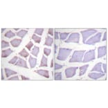 Immunohistochemistry - Anti-XIAP Antibody (B0599) - Antibodies.com