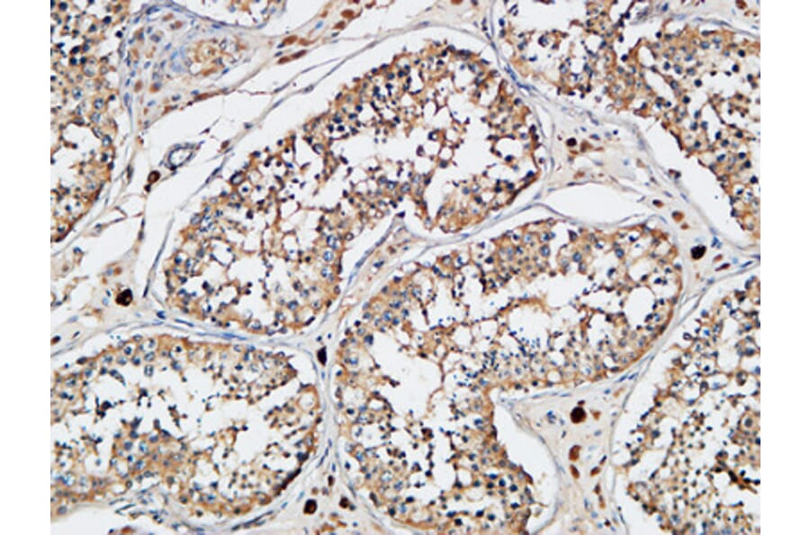Immunohistochemistry - Anti-XIAP Antibody (B0599) - Antibodies.com