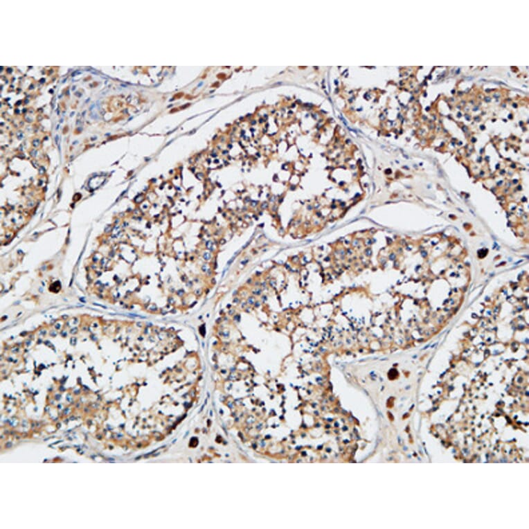 Immunohistochemistry - Anti-XIAP Antibody (B0599) - Antibodies.com