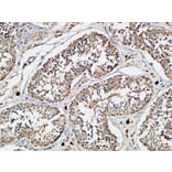 Immunohistochemistry - Anti-XIAP Antibody (B0599) - Antibodies.com