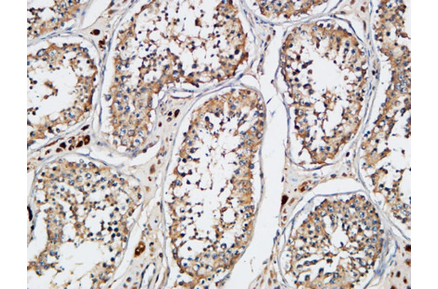 Immunohistochemistry - Anti-XIAP Antibody (B0599) - Antibodies.com